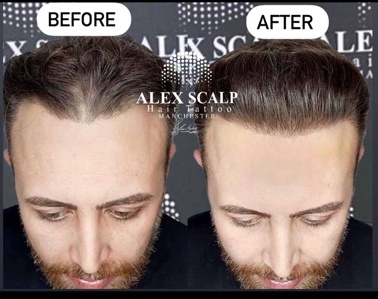 SMP healed result example 11