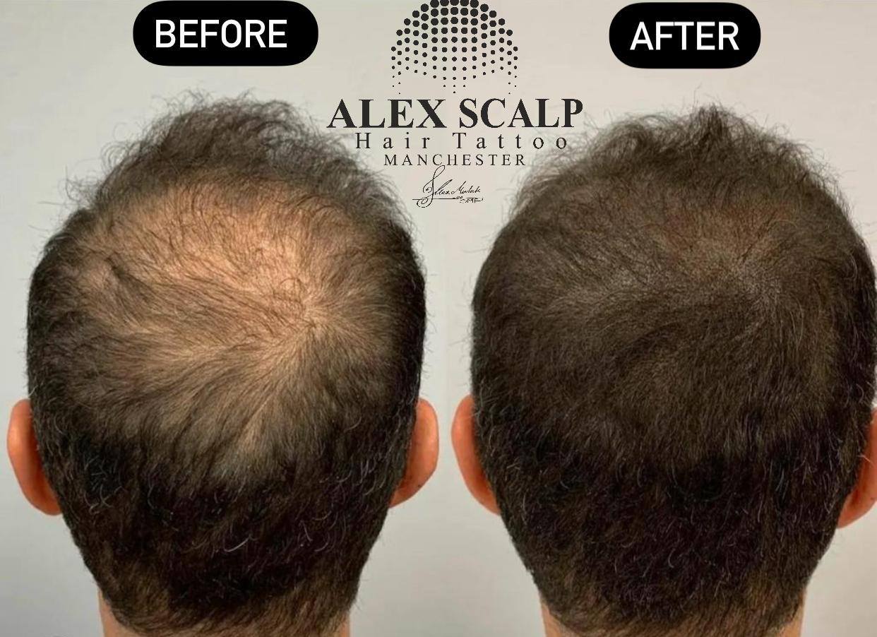 SMP healed result example 2