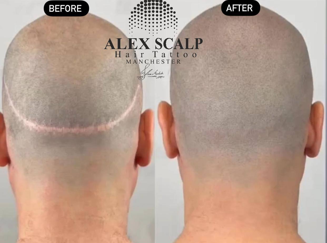 SMP healed result example 3