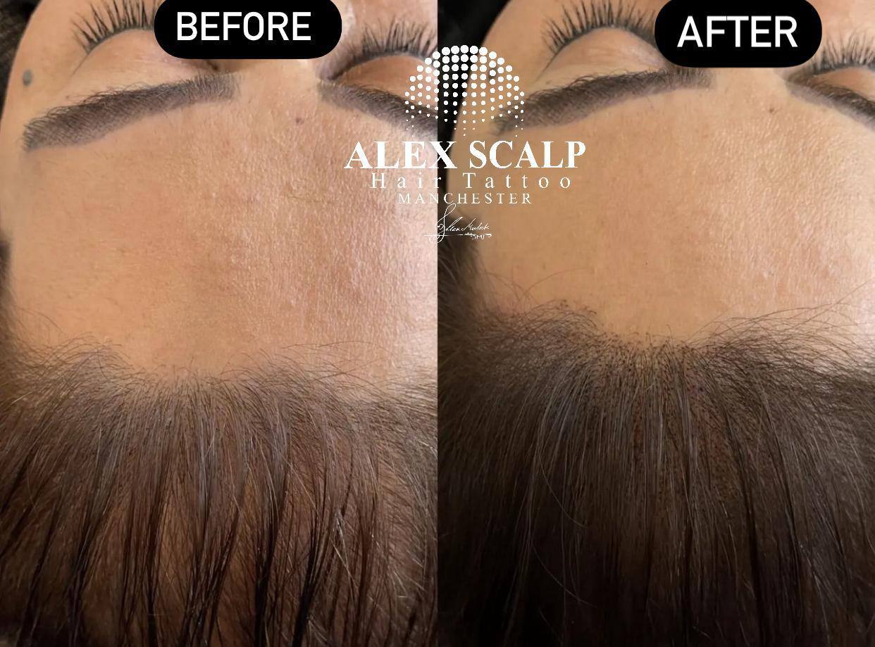 SMP healed result example 5