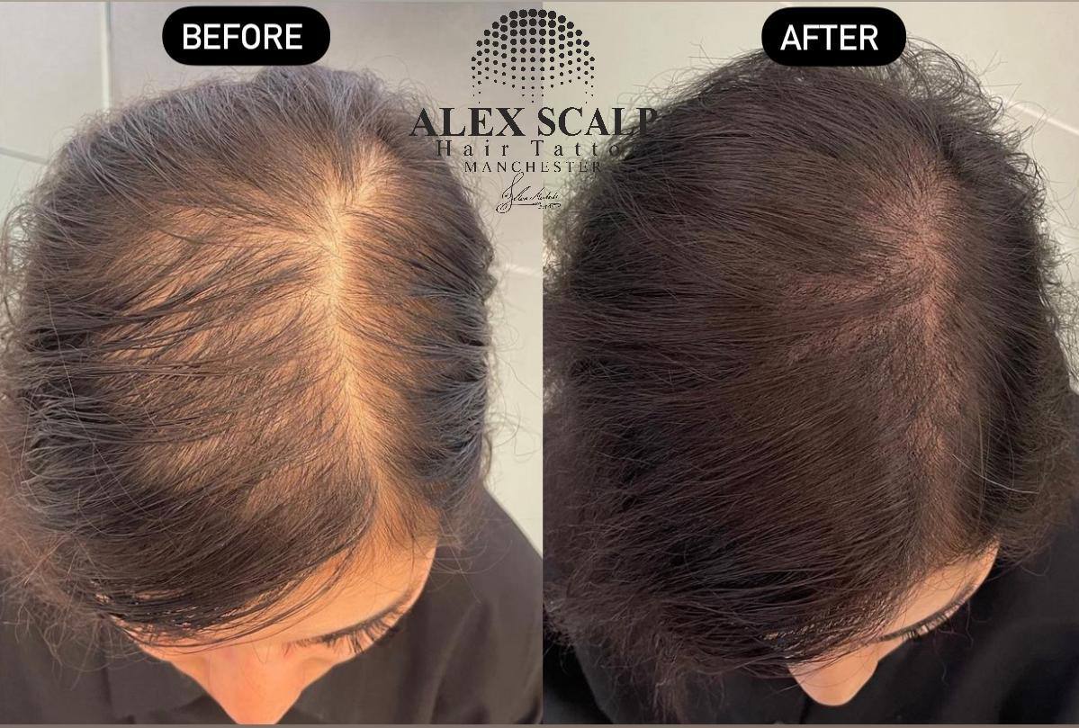 SMP healed result example 6