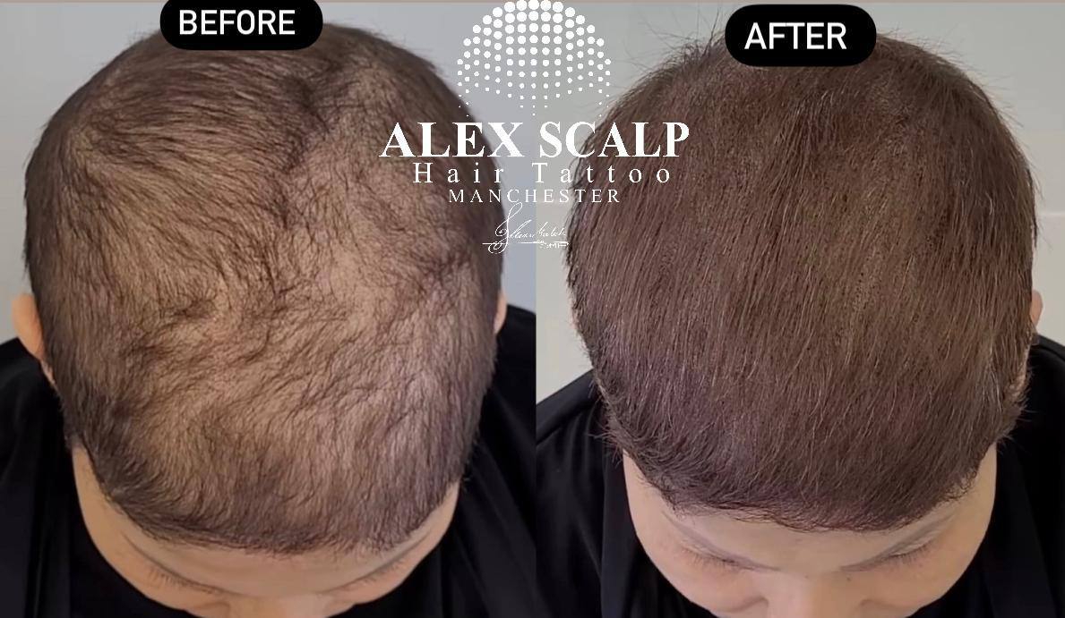 SMP healed result example 7